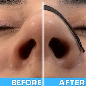 Nasal Strips by GirlyShop™ |Breathe Better